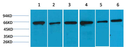 AMPK Alpha2 Polyclonal Antibody (F119)
