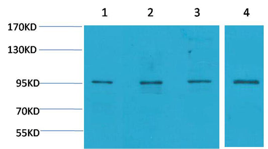ERK3 Polyclonal Antibody (F138)