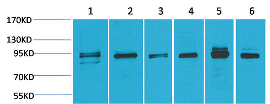 ERK5 Polyclonal Antibody (F139)