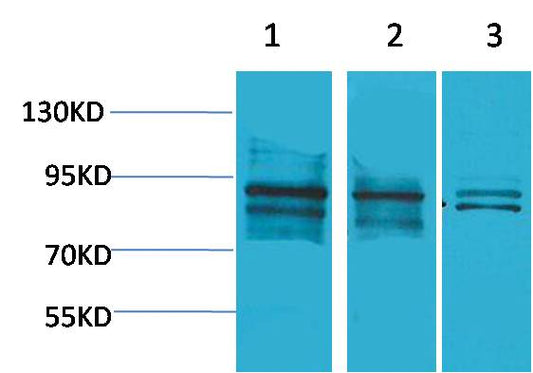 HIF-1Beta ARNT Polyclonal Antibody (F143)