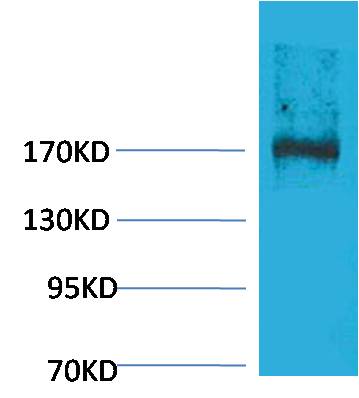 EPG5 Polyclonal Antibody (21-120)
