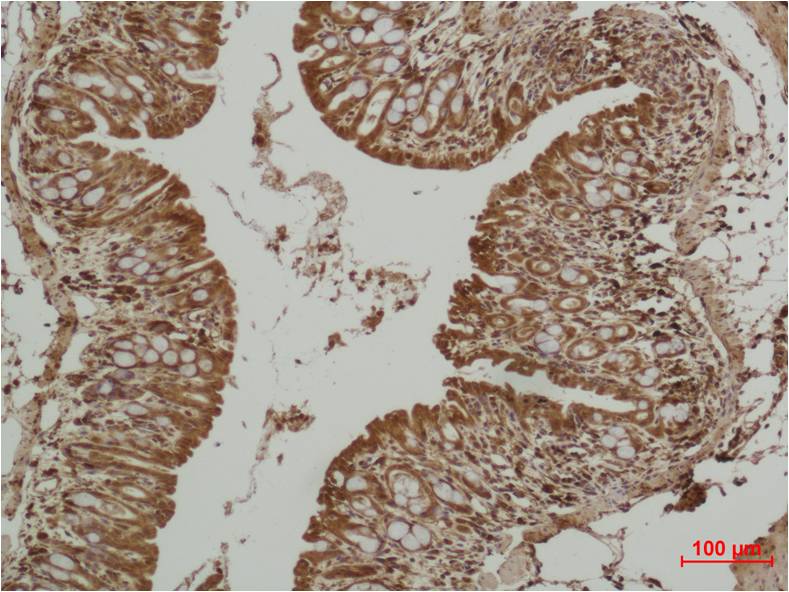 P53 Polyclonal Antibody