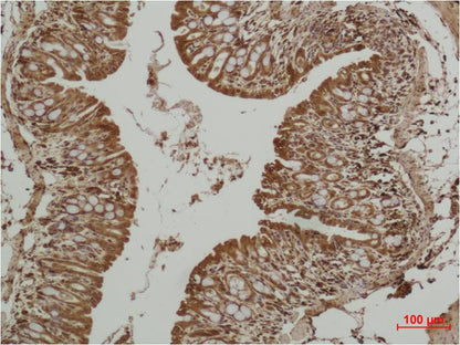 P53 Polyclonal Antibody
