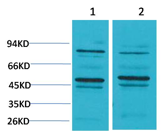 Bestrophin-2 Polyclonal Antibody (A185)