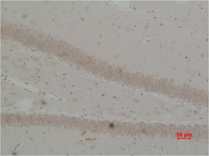 Bestrophin-2 Polyclonal Antibody (A185)