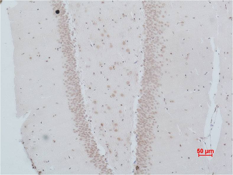 NMBR (Bombesin Receptor 1) Polyclonal Antibody (A186)