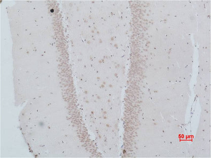NMBR (Bombesin Receptor 1) Polyclonal Antibody (A186)