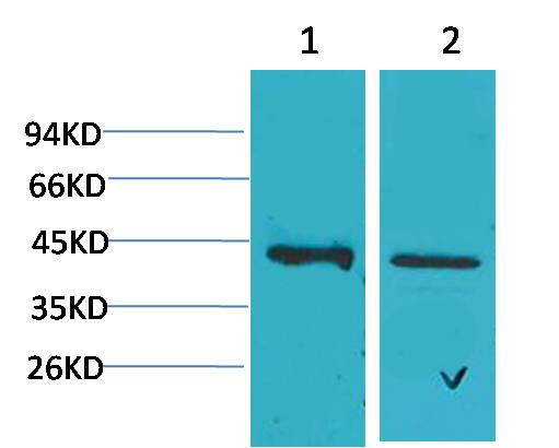CALHM1 Polyclonal Antibody (A191)