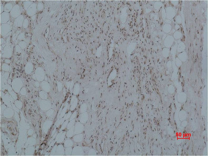 CALHM1 Polyclonal Antibody (A191)