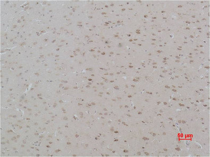 Calcium Sensing Receptor Polyclonal Antibody (A192)