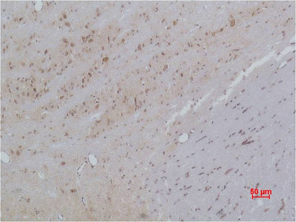 Cav Beta3 Polyclonal Antibody (A195)