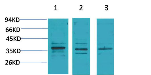 Cav Gamma2 Polyclonal Antibody (A196)