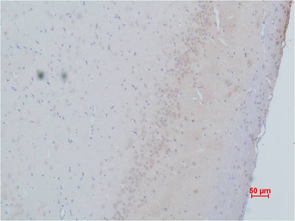 Cav Gamma2 Polyclonal Antibody (A196)