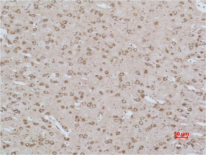 Cav Gamma3 Polyclonal Antibody (A197)