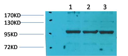 eEF1A2 Binding Protein Polyclonal Antibody (1)