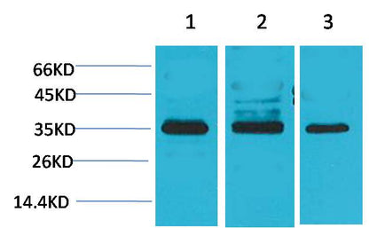 Cav Gamma4 Polyclonal Antibody (A198)