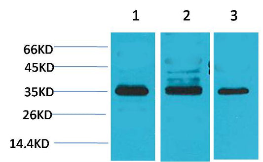 Cav Gamma4 Polyclonal Antibody (A198)