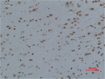 Cav Gamma4 Polyclonal Antibody (A198)