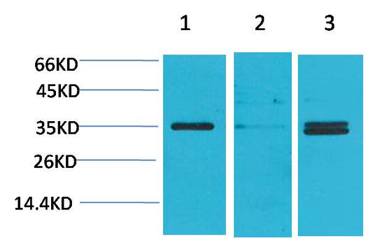 Cav Gamma5 Polyclonal Antibody (A199)