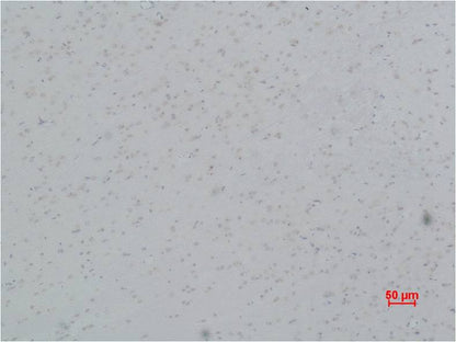 Cav Gamma5 Polyclonal Antibody (A199)