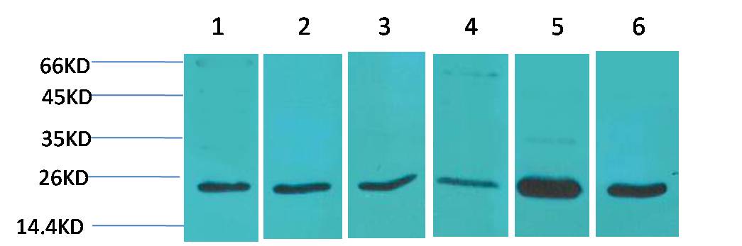 SOD2 Polyclonal Antibody (F238)
