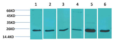 SOD2 Polyclonal Antibody (F238)