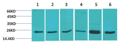 SOD2 Polyclonal Antibody (F238)