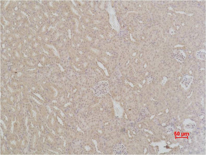 SOD2 Polyclonal Antibody (F238)