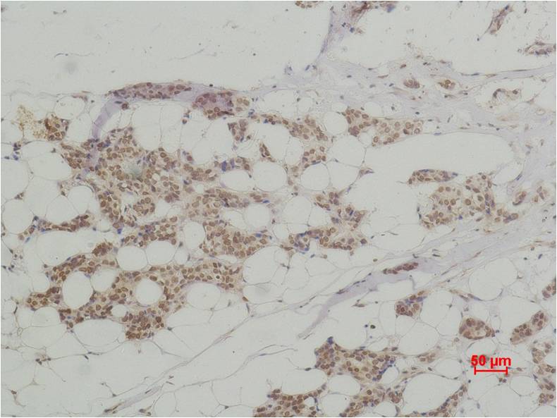 Histone H3 (Citruline R2+R8+R17) Polyclonal Antibody (A281)