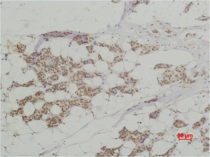 Histone H3 (Citruline R2+R8+R17) Polyclonal Antibody (A281)