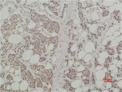 Histone H3 (Citruline R26) Polyclonal Antibody (A282)