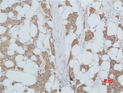 PI3 Kinase P85Alpha Polyclonal Antibody (F219)