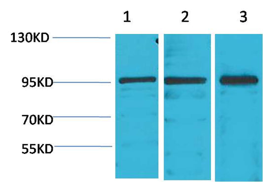 STAT2 Polyclonal Antibody (F242)