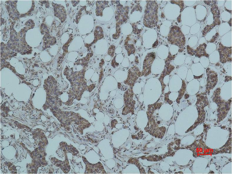 Smad3 Polyclonal Antibody (F233)