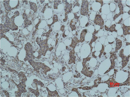 Smad3 Polyclonal Antibody (F233)