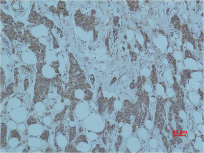 Smad3 Polyclonal Antibody (F234)