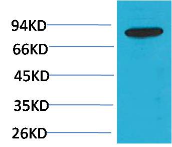 PI3 Kinase P85Beta Polyclonal Antibody (F221)