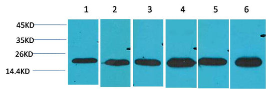 SOD2 Polyclonal Antibody (F239)