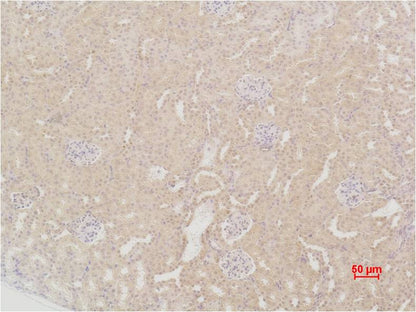 SOD2 Polyclonal Antibody (F239)
