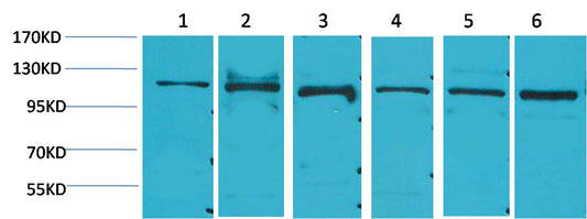 STAT2 Polyclonal Antibody (F243)
