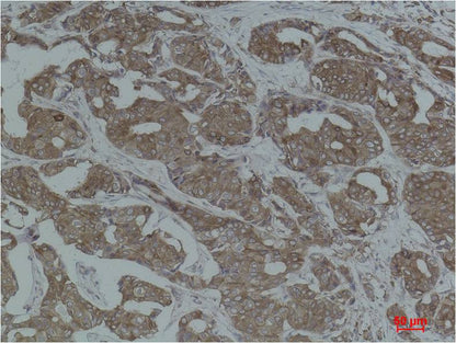 Calnexin Polyclonal Antibody (F272)