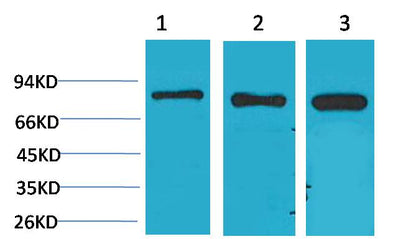 P70 S6 Kinase Polyclonal Antibody (F293)