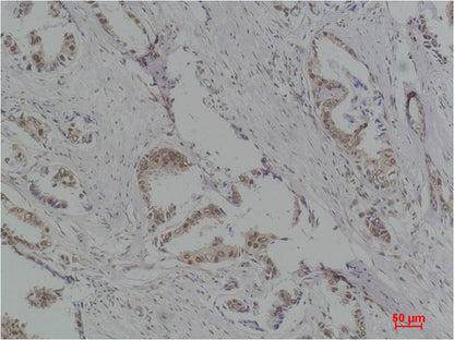 P70 S6 Kinase Polyclonal Antibody (F293)