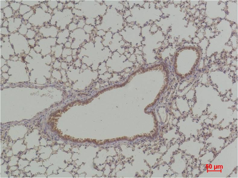P70 S6 Kinase Polyclonal Antibody (F294)