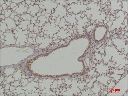 P70 S6 Kinase Polyclonal Antibody (F294)