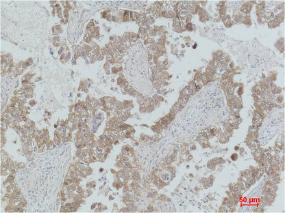 MEK2 Polyclonal Antibody (F189)