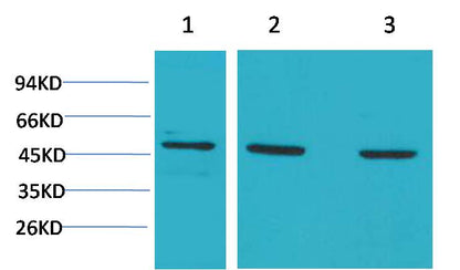 MEK5 Polyclonal Antibody (F195)