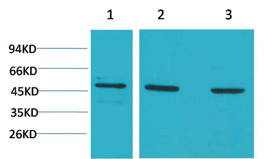 MEK5 Polyclonal Antibody (F195)