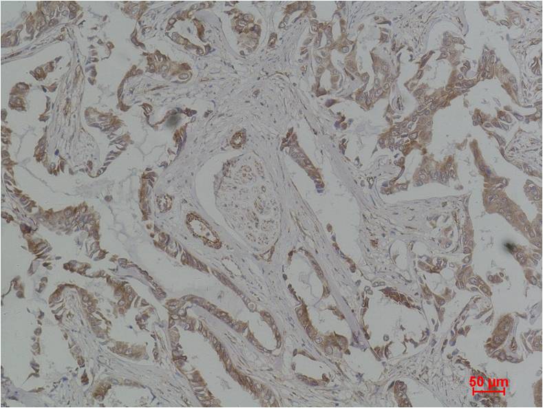 MEK5 Polyclonal Antibody (F195)