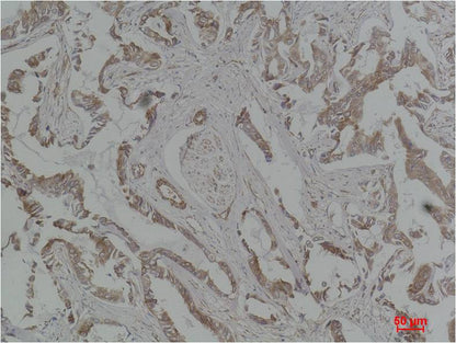 MEK5 Polyclonal Antibody (F195)